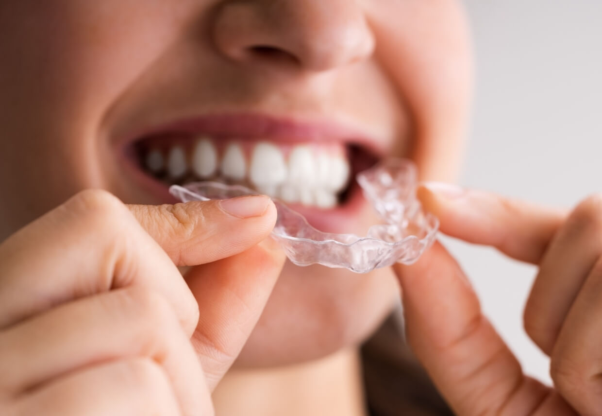 Common Sports That Require Mouthguards