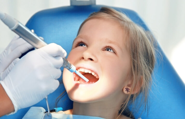Dental Sealants for Kids