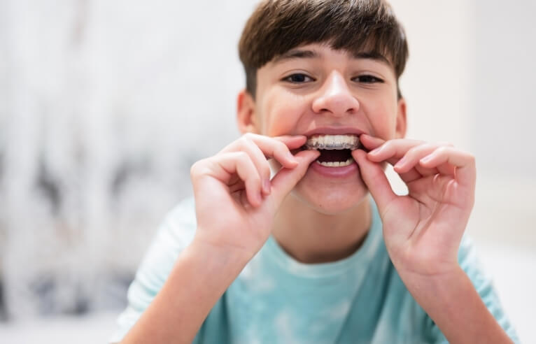 Interceptive Orthodontics