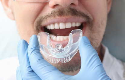 Sports Guards / Athletic Mouthguards