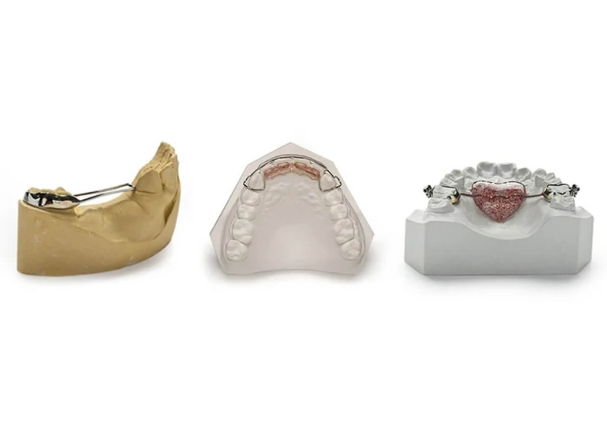 Types of Space Maintainers