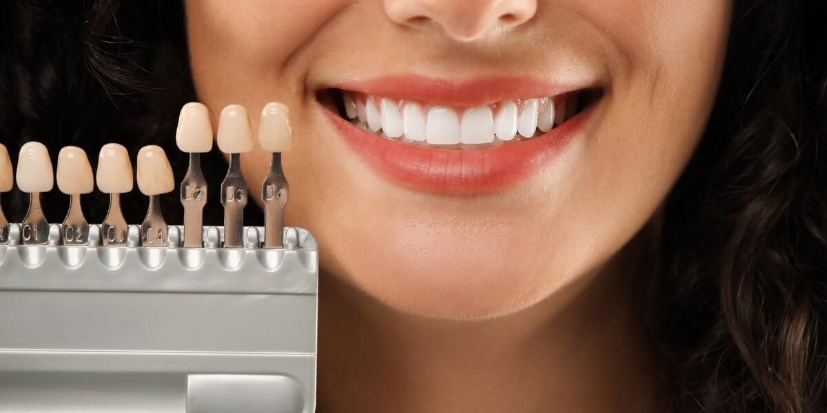 What to Expect After Your Implant Consultation